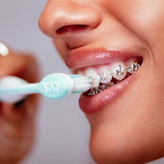 a patient with braces brushing their teeth